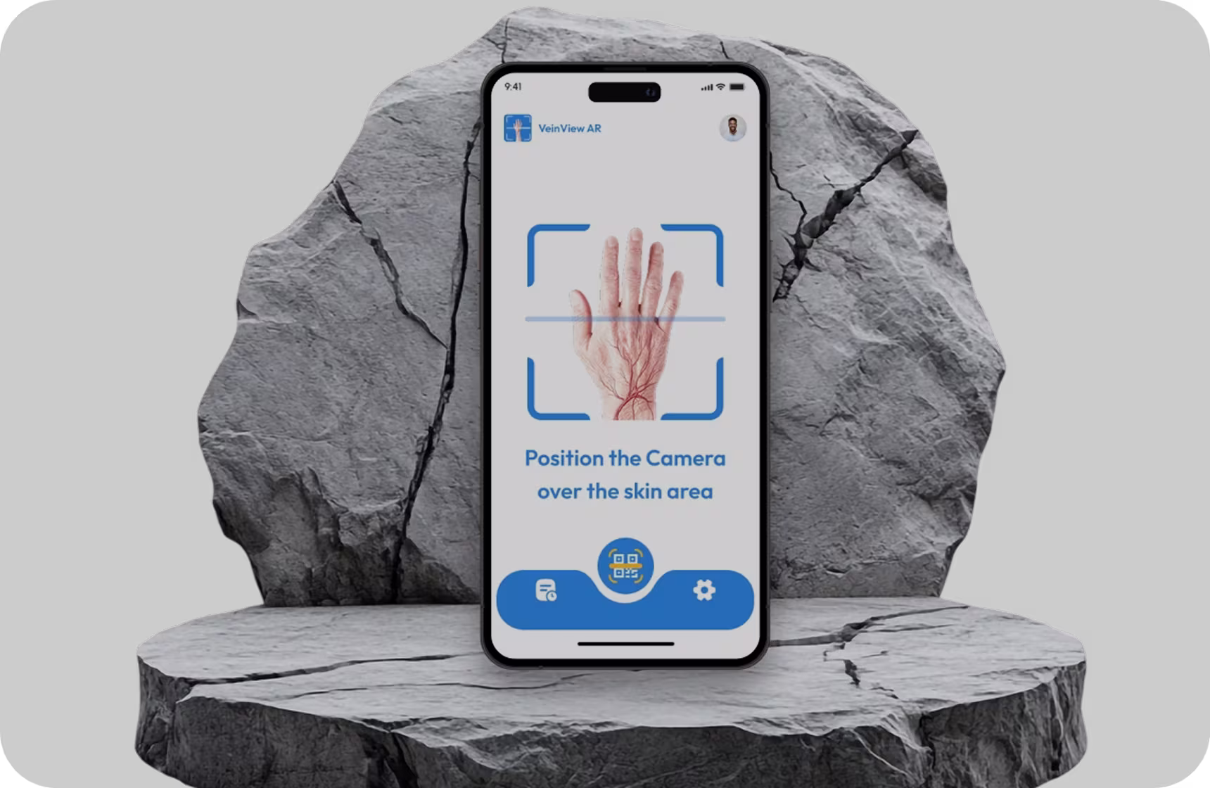 VeinView AR