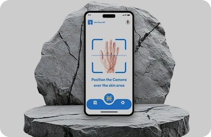VeinView AR